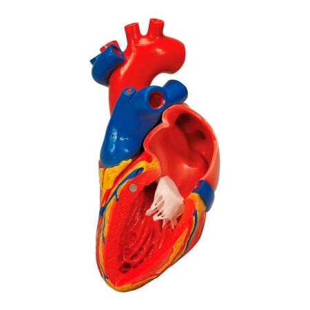 Fabrication Enterprises 3B Anatomical Model - Heart with Bypass, 2-Part 974804